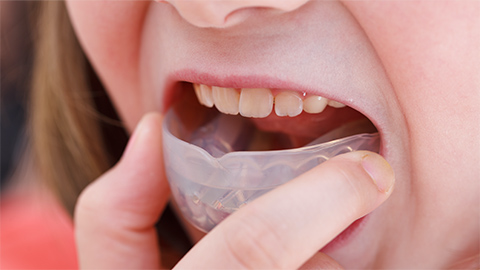 歯列矯正用咬合誘導装置