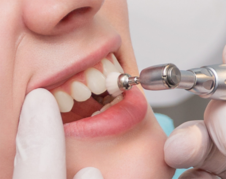 PMTC、クリーニング